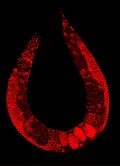 "C_elegans_stained.jpg" by User:Quadell